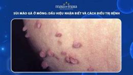 ảnh chụp màn hình cách trị da gà ở mông