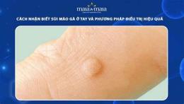 ảnh chụp màn hình cách trị da gà ở tay
