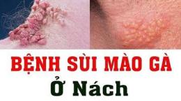 ảnh chụp màn hình da gà ở nách