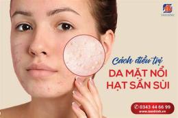 ảnh chụp màn hình da mặt nổi sần như da gà