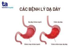 ảnh chụp màn hình đau dạ dày có được ăn thịt gà không