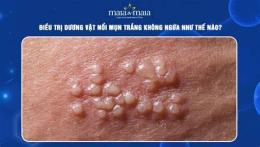 ảnh chụp màn hình dương vật nổi hột như da gà