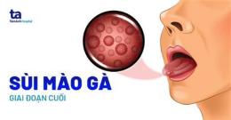 ảnh chụp màn hình kham benh sui mao ga o benh vien da lieu