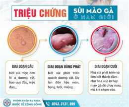 ảnh chụp màn hình nổi da gà ở dương vật