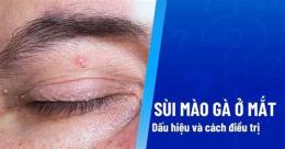ảnh chụp màn hình sùi mào gà ở da mặt