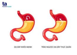 ảnh chụp màn hình trào ngược dạ dày ăn thịt gà có được không