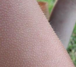 ảnh chụp màn hình tự nhiên bị nổi da gà