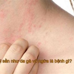 bị da gà ở cổ