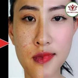 cách làm trắng da bằng lòng đỏ trứng gà