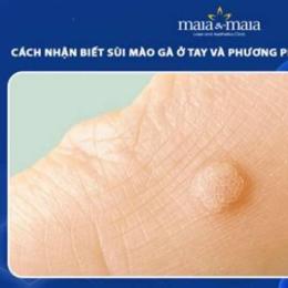cách trị da gà ở tay