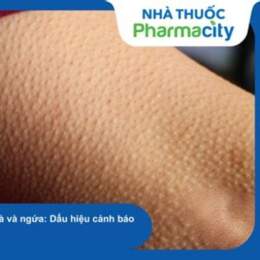 cách trị da sần như da gà ở có