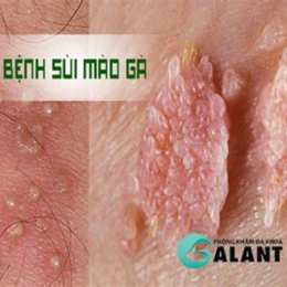 da ga benh vien