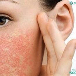 da mặt bị nổi hột như da gà