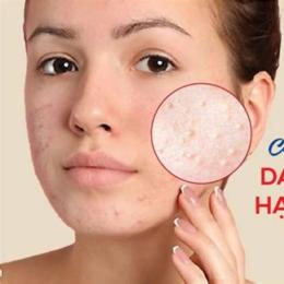 da mặt nổi sần như da gà