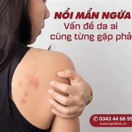 da nổi mẩn ngứa như da gà