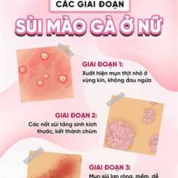 địa chỉ chữa bệnh sùi mào gà ở đà lạt