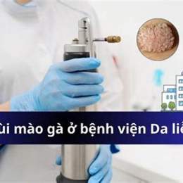 đốt sùi mào gà, bệnh viện da liễu