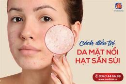 giao diện app da mặt nổi sần như da gà