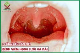 giao diện app gà đá bị viêm họng