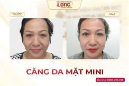 giao diện app lam cang da mat voi trung ga