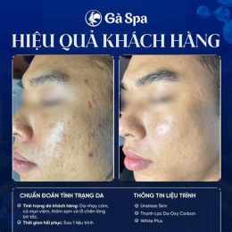 giao diện app mụn da gà