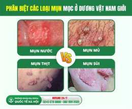 giao diện app nổi da gà ở dương vật