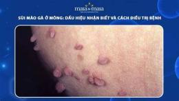 giao diện app trị da gà ở mông