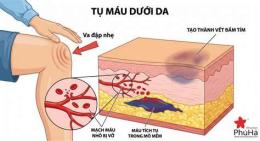 giao diện app tụ máu dưới da chân gà