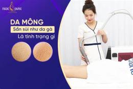 hướng dẫn sử dụng da có sần sùi như da gà