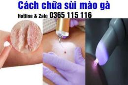 hướng dẫn sử dụng địa chỉ trị sùi mào gà ở đà nẵng