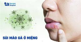 hướng dẫn sử dụng kham benh sui mao ga o benh vien da lieu