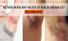 hướng dẫn sử dụng nách bị nổi da gà