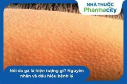 hướng dẫn sử dụng nổi da gà