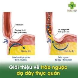 hướng dẫn sử dụng trào ngược dạ dày ăn thịt gà có được không