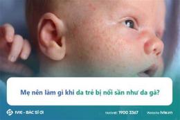 hướng dẫn sử dụng trẻ sốt kèm nổi da gà