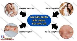 hướng dẫn sử dụng tri benh sui mao ga o benh vien da lieu