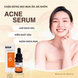 mụn đầu trắng gần môi