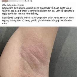 nách bị da gà