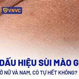 nếu đã bị sùi mào gà mà chích hpv thì sao