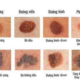 những hình ảnh làm nổi da gà