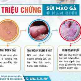 nổi da gà ở dương vật