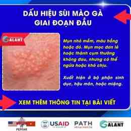 sui mao ga benh vien da