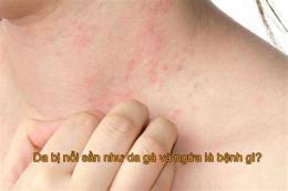 tính năng nổi bật bị da gà ở cổ