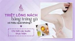 tính năng nổi bật cách trị nách da gà