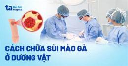 tính năng nổi bật chua sui mao ga o benh vien da lieu trung uong