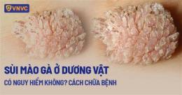 tính năng nổi bật da gà có gây ho không
