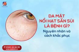 tính năng nổi bật da mặt nổi sần như da gà