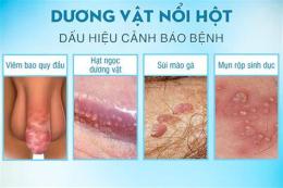 tính năng nổi bật dương vật nổi hột như da gà