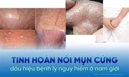 tính năng nổi bật mụn da gà