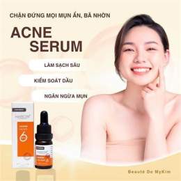 tính năng nổi bật mụn đầu trắng gần môi